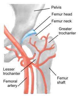 HealthyHip_EN_sm